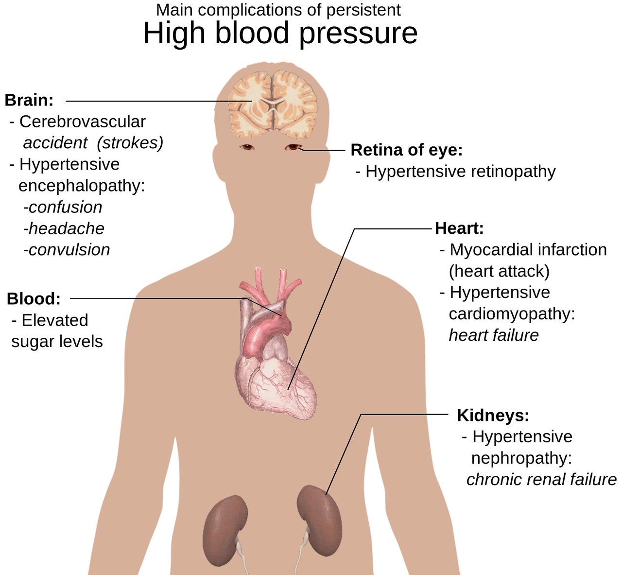 Paramount Preeclampsia Pregnancy Facts You Need To Know