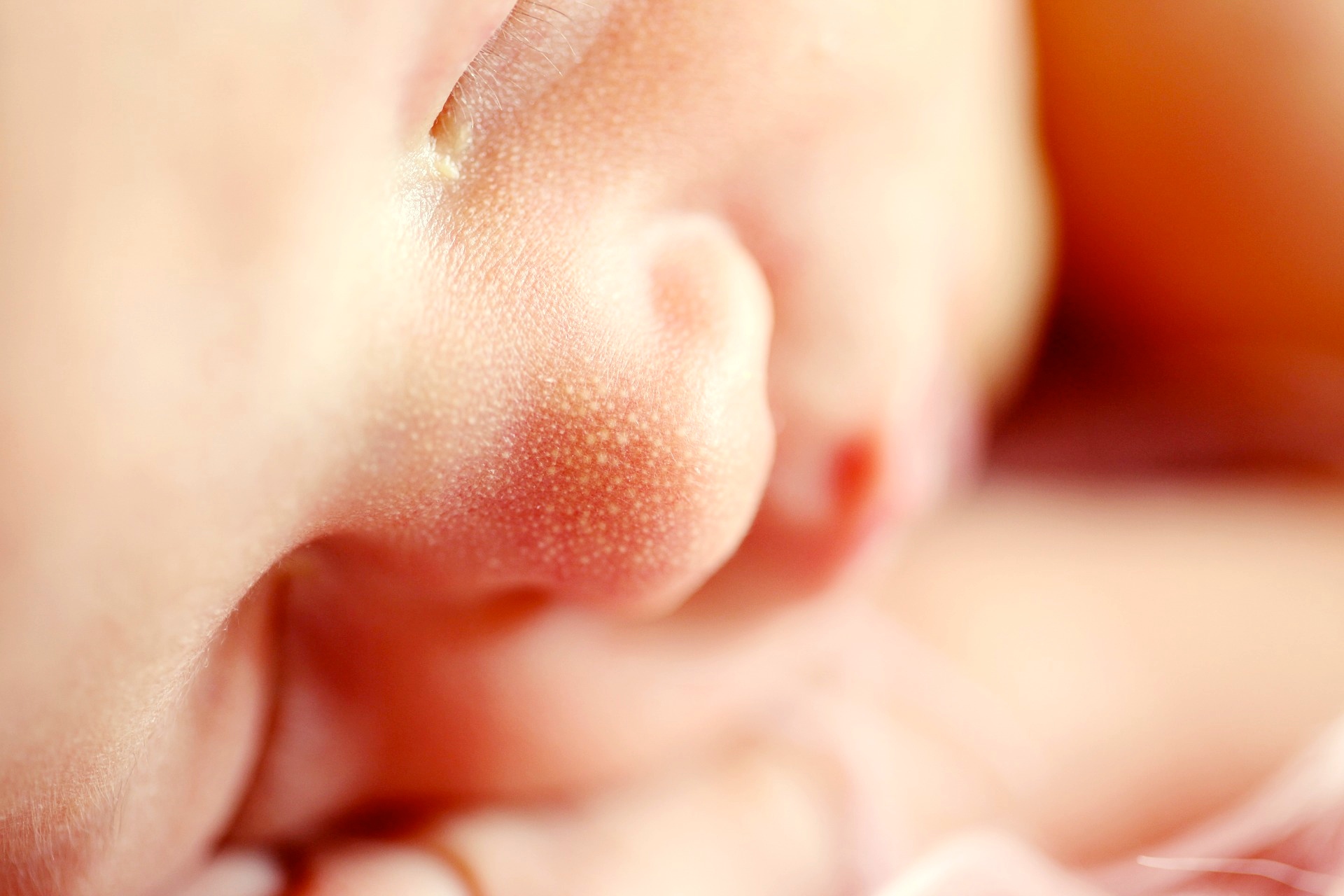 Paramount Preeclampsia Pregnancy Facts You Need To Know