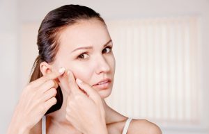 How to Clear Adult Acne: 14 Acne Removal Tips and Tricks