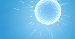 An absence of ovulation is a common PCOS question - fertility 