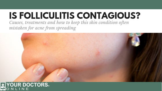 Is Folliculitis Contagious?