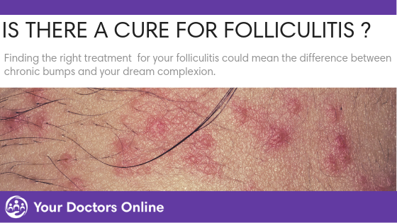 Is There a Cure for Folliculitis?