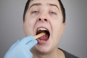 Is Tonsillitis Contagious?