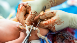 placenta previa is one reason for bleeding after sex during pregnancy