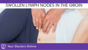 swollen lymph nodes in the groin