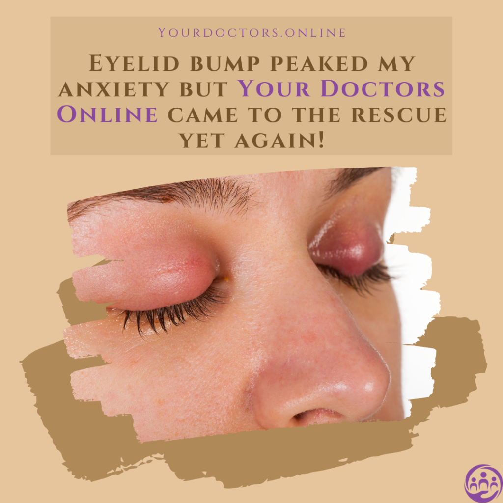 Chat with a doctor about eyelid bump