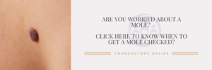 When to get a mole checked? 