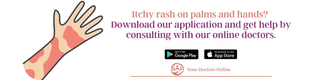 Online doctor for itchy rash