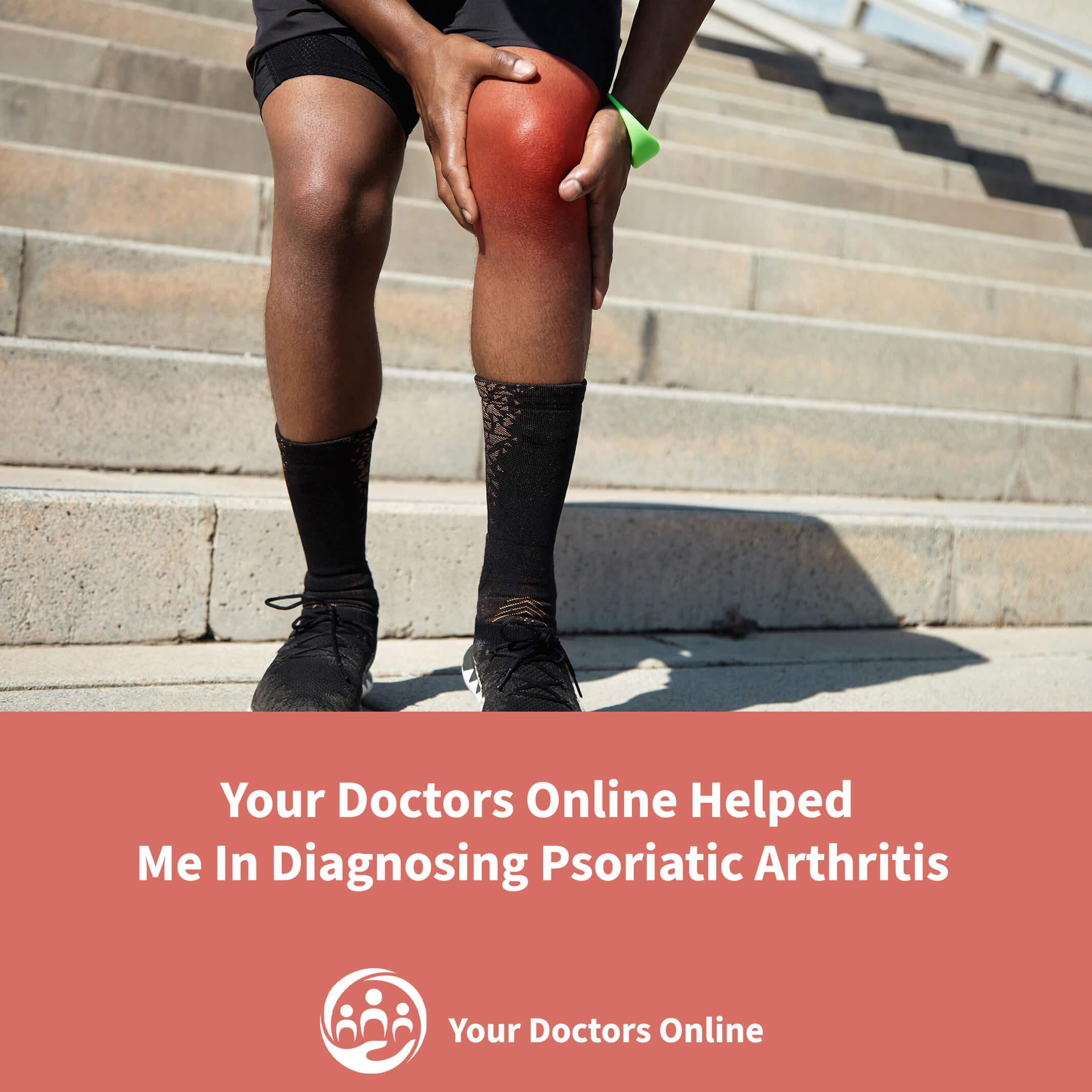 Your Doctors Online Helped Me In Diagnosing Psoriatic Arthritis!