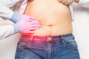 Your Doctors Online Helped Me Determine That My Symptoms Were Due To Gallstones!