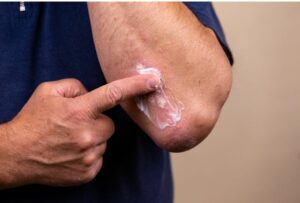 uses and side effects of triamcinolone