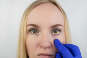 Jaundice treatment