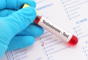 Testosterone test