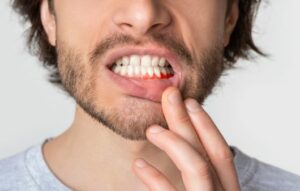 amoxicillin for tooth infection